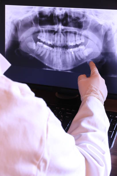 Best Emergency Dentist for Knocked-Out Tooth in Baxter, TN